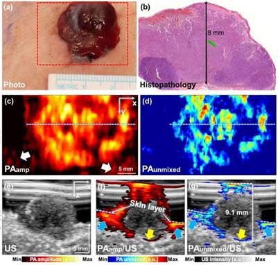 Frontiers Clinical Photoacoustic Ultrasound Dual Modal Imaging